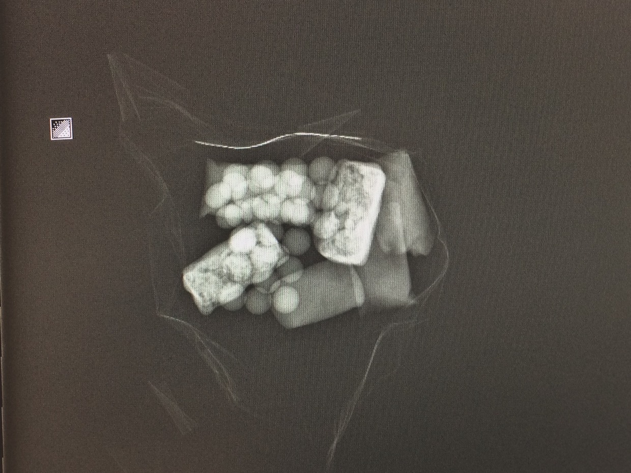 This Bushwick Urgent Care Center Will X-Ray Halloween Candy For Sharp, Hazardous Objects